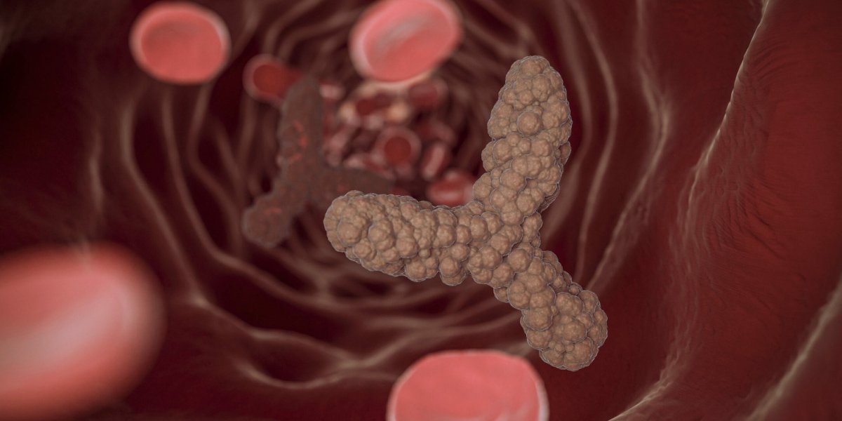 Три неочевидных признака, которые могут говорить о высоком холестерине Три неочевидных признака, которые могут говорить о высоком холестерине
